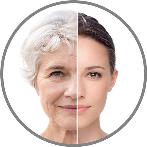 Anti Aging